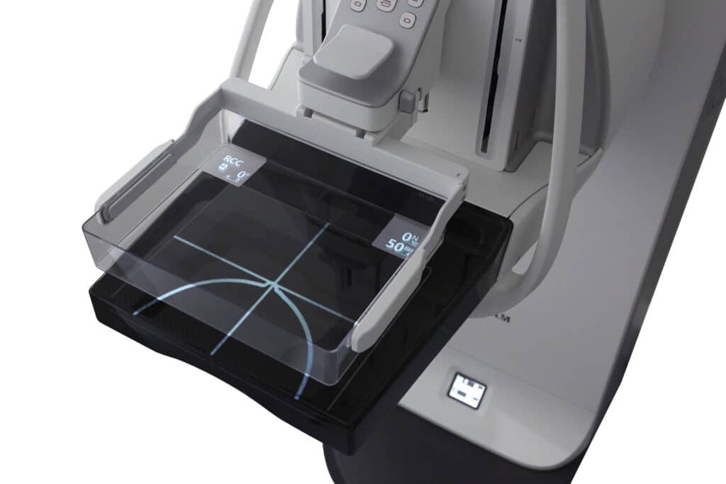 Mammografia digitale Amulet Sophinity di FUJIFILM per diagnostica senologica avanzata