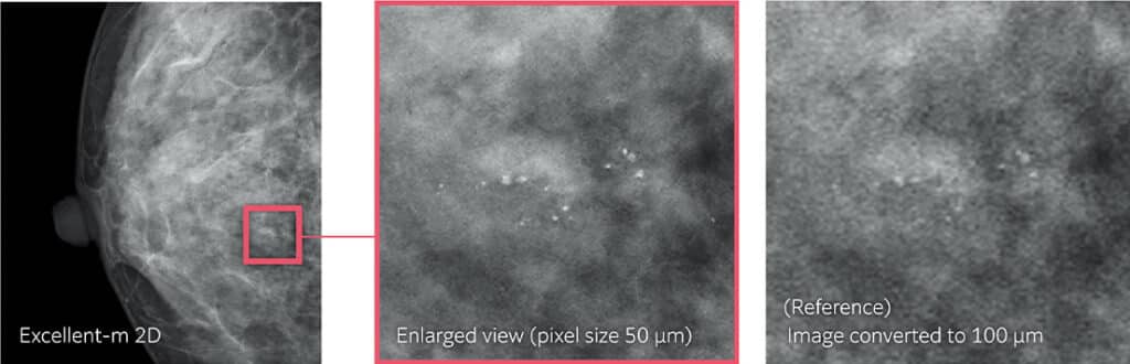 Mammografia digitale Amulet Sophinity di FUJIFILM per diagnostica senologica avanzata