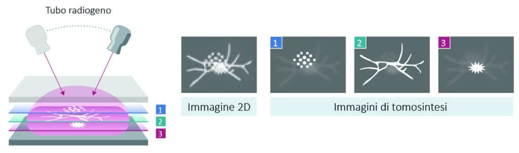 Mammografia digitale Amulet Sophinity di FUJIFILM per diagnostica senologica avanzata